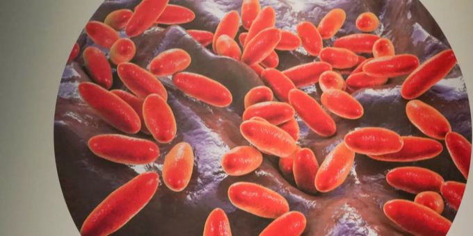 Abbildung des für die Beulen- und Lungenpest verantwortlichen Bakteriums Yersinia pestis. Abbildung Pest