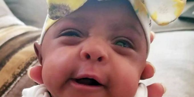 Erst jetzt aus dem Krankenhaus entlassen: Das Baby «Saybie». Foto: Sharp HealthCare/AP Erst jetzt aus dem Krankenhaus entlassen: Das Baby «Saybie». Foto: Sharp HealthCare/AP