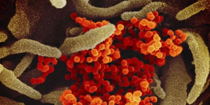 Eine rasterelektronenmikroskopische Aufnahme zeigt das Coronavirus Sars-CoV-2 (orange). Foto: Uncredited/NIAID-RML/AP/dpa/Symbolbild antikörper waffe