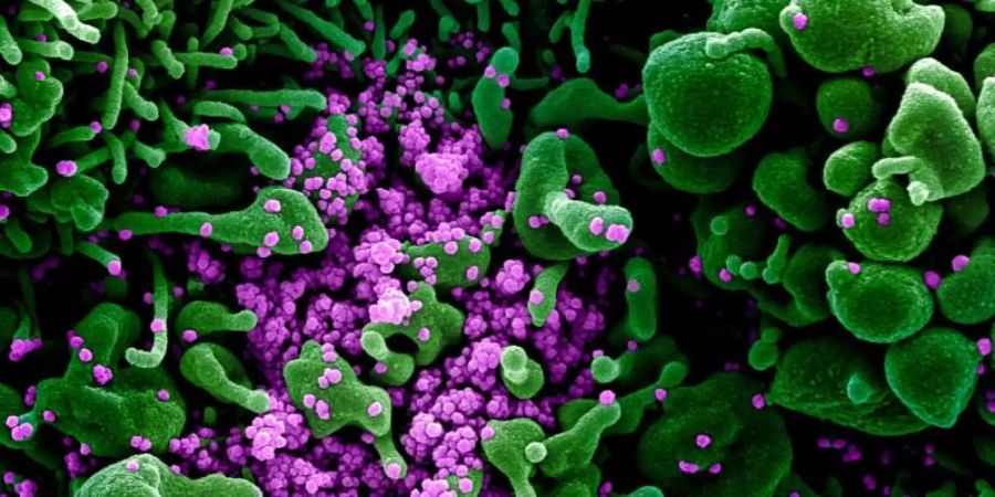 Eine Zelle (grün) ist mit dem Coronavirus (SARS-CoV-2, violett) infiziert. Foto: Niaid/Europa Press/dpa