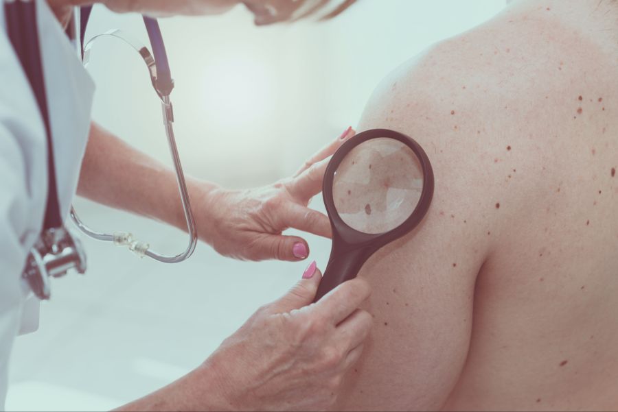 Dermatologische Untersuchung, Lupe