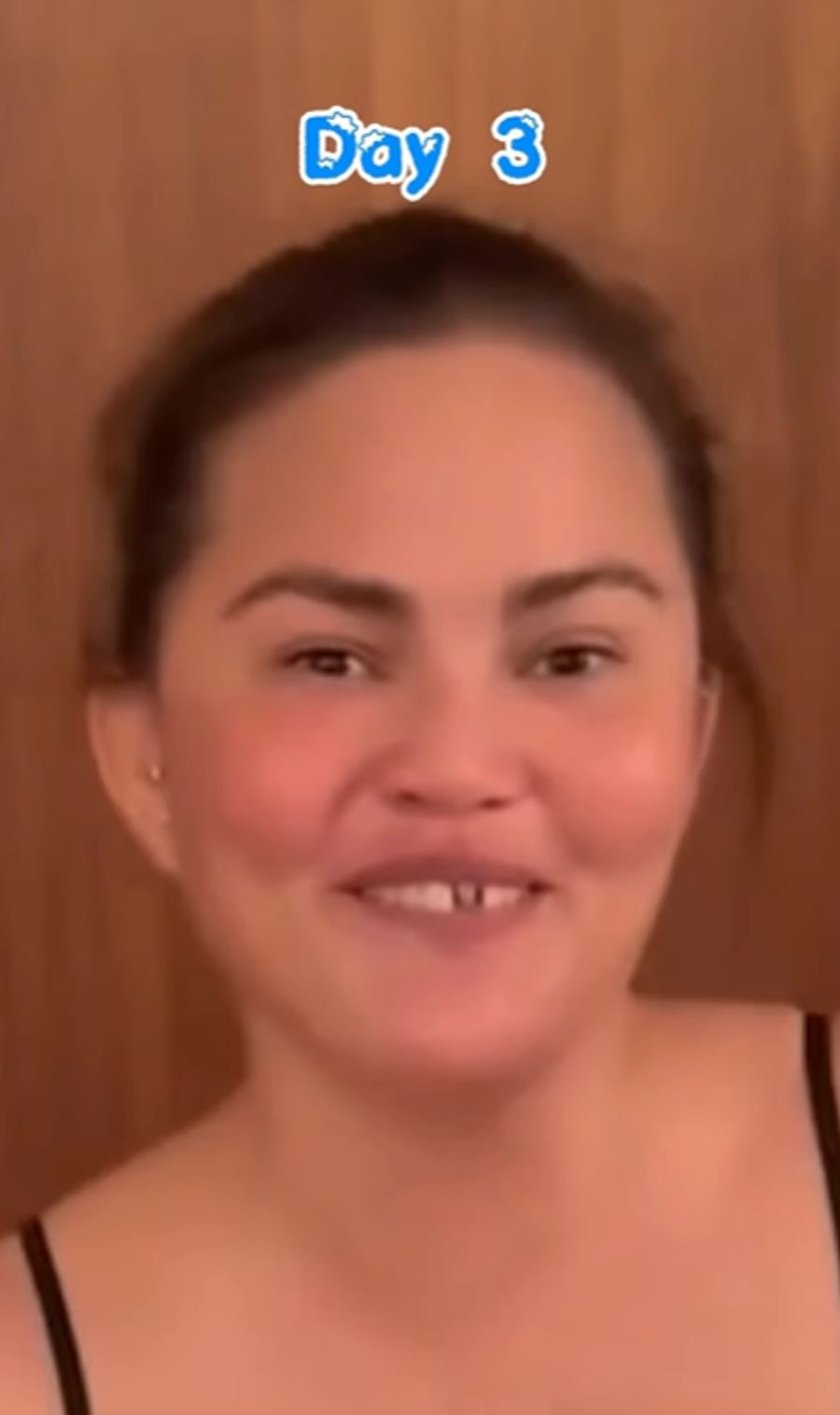 Huch! Plötzlich ist nur noch der Zahnstummel zu sehen.