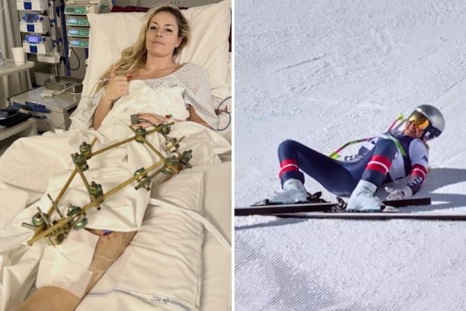 Olympia 2026 Lindsey Vonn