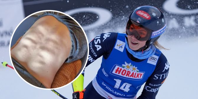 Mikaela Shiffrin Rücken