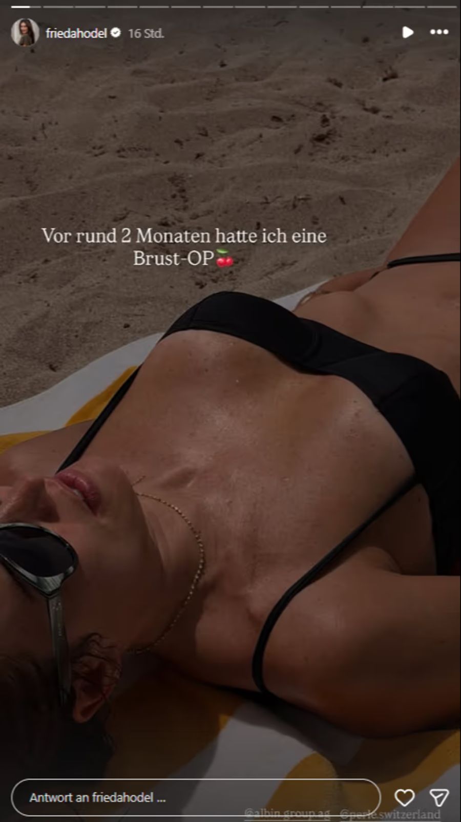 In ihrer Instagram-Story gesteht Ex-Bachelorette Frieda Hodel: Sie hat sich die Brüste operieren lassen.