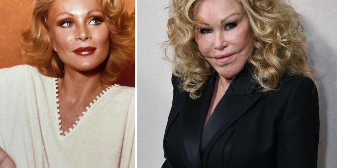 So sah die Schweizer «Katzenfrau» Jocelyn Wildenstein früher aus. katzenfrau jocelyn wildenstein