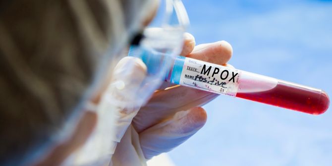 mpox