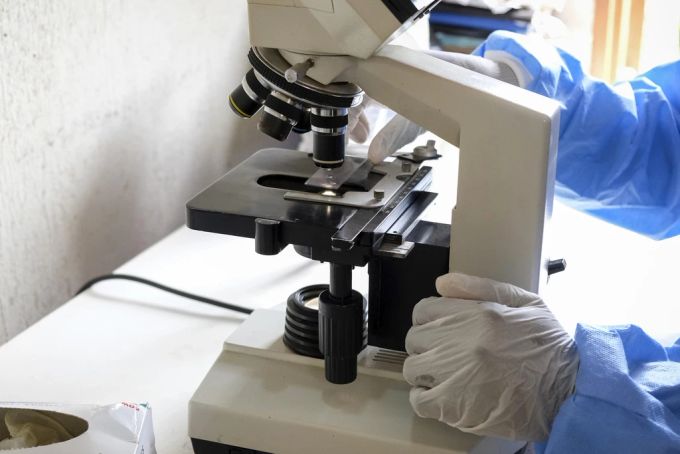 Ebola wird in einem Labor untersucht. uganda